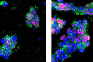 Rymdceller600_1.jpeg Bilden visar celler som förökar sig i de 3D-printade stödstrukturerna. Till vänster: Stamceller i kontrollgruppen. Till höger: Stamceller som har varit i rymden och förökar sig snabbt.