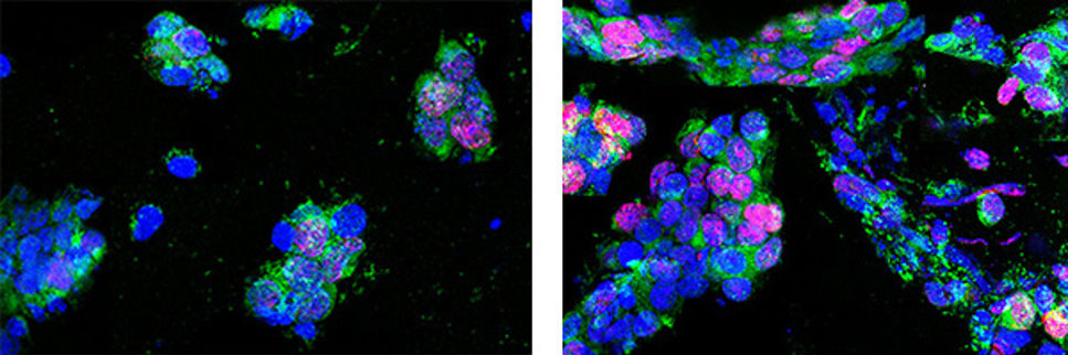 Bilden visar celler som förökar sig i de 3D-printade stödstrukturerna. Till vänster: Stamceller i kontrollgruppen. Till höger: Stamceller som har varit i rymden och förökar sig snabbt.